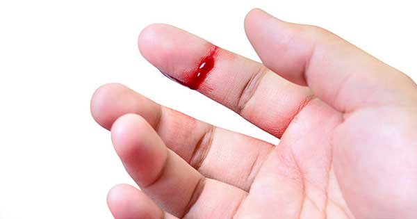 heridas, ferides, ferí; Ferir, v., lat. ferire, frapper. heridas, ferides, ferí; Ferir, v., lat. ferire, frapper.