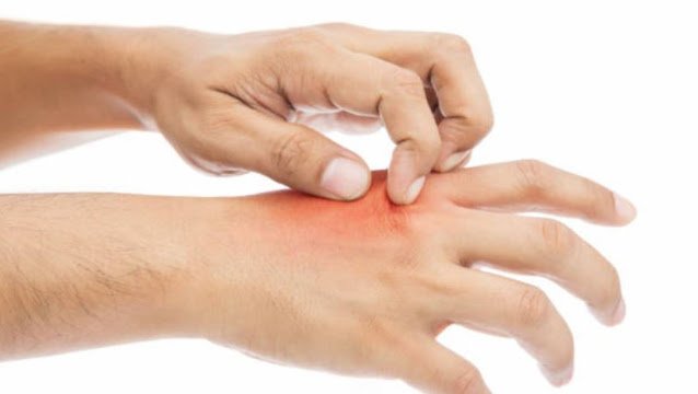 rascar, rascá; Gratar, gratter, égratigner. 